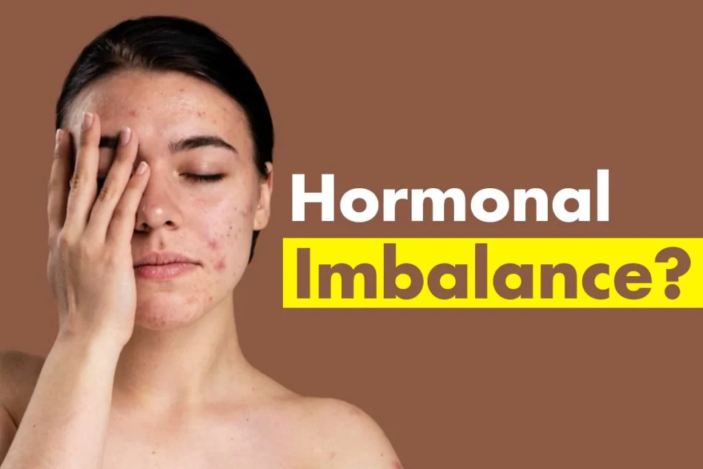 Hormonal Disorder